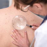 Three in Four Adults 70 and Older Have at Least One Skin Disease