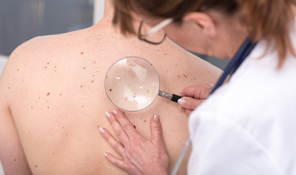 Three in Four Adults 70 and Older Have at Least One Skin Disease